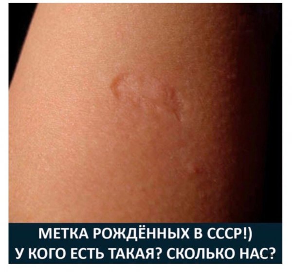 cu9rWMtWsGY