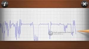 seismograph