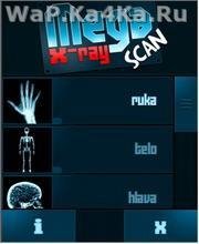 Mega X -Ray