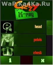 Crazy X-Ray